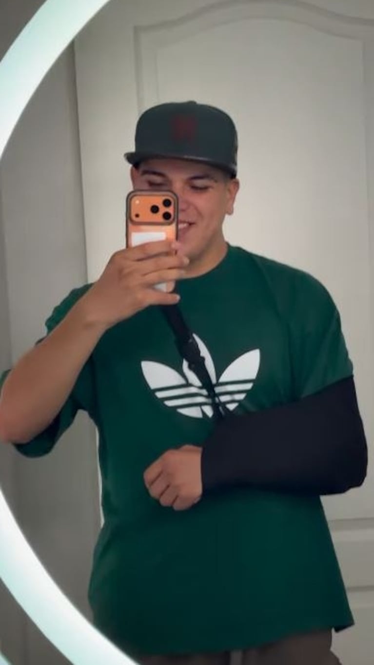Thiago Medina mostró cómo quedó luego de un accidente mientras entrenaba boxeo. (Foto: Instagram/thi4go_km)