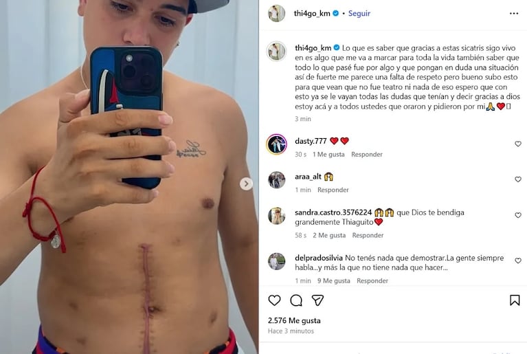 Thiago Medina mostró las cicatrices por el accidente en moto e impresionó a todos