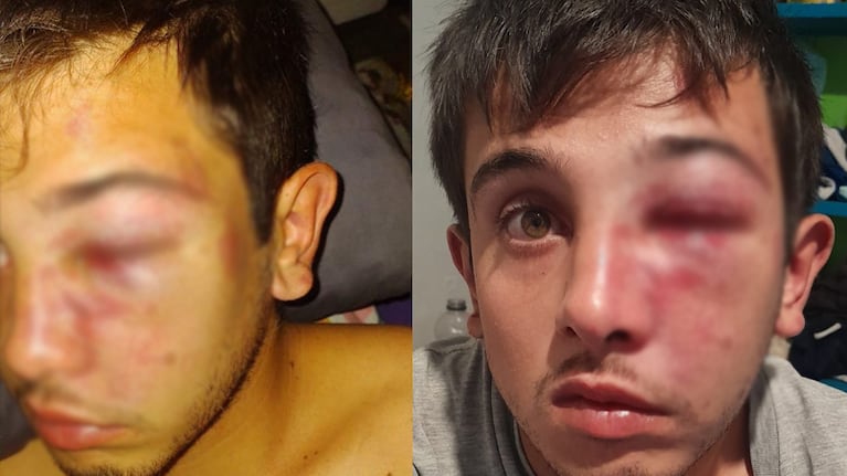 Tomás sufrió graves lesiones en su cara.