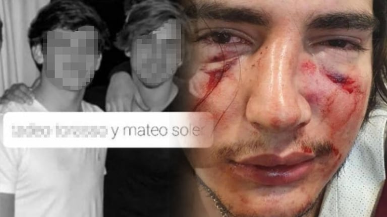 Tras el grave incidente, Lautaro Insúa denunció todo en su Instagram.