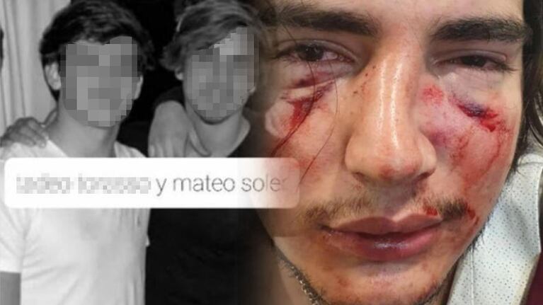 Tras el grave incidente, Lautaro Insúa denunció todo en su Instagram.