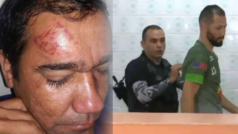 Tras la feroz patada que quedó marcada en la frente del árbitro, así se llevaron al jugador.