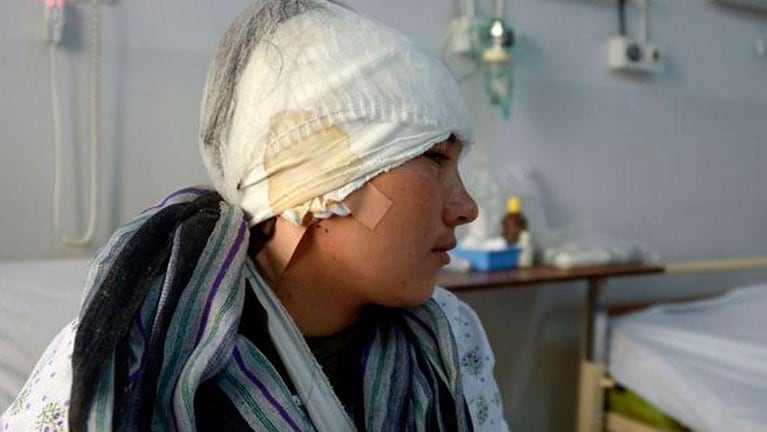 Un afgano le cortó las orejas a su mujer por mirar a otros hombres