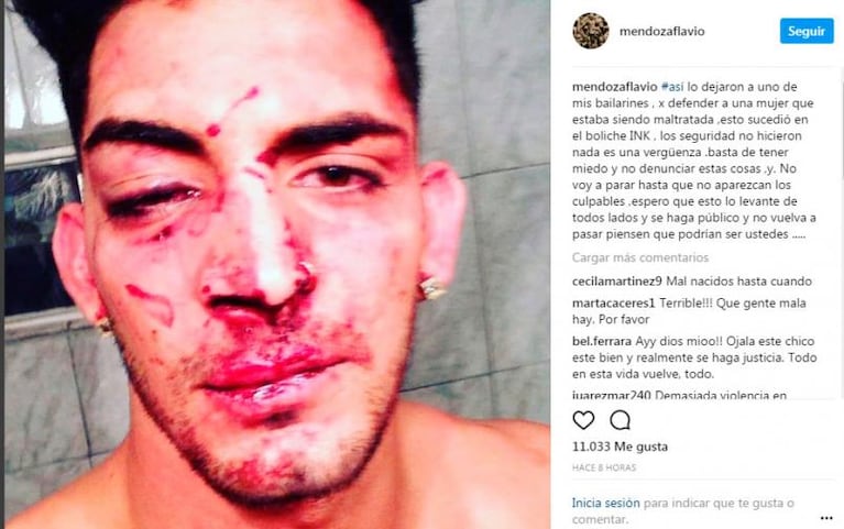 Un bailarín de Flavio Mendoza sufrió una agresión brutal