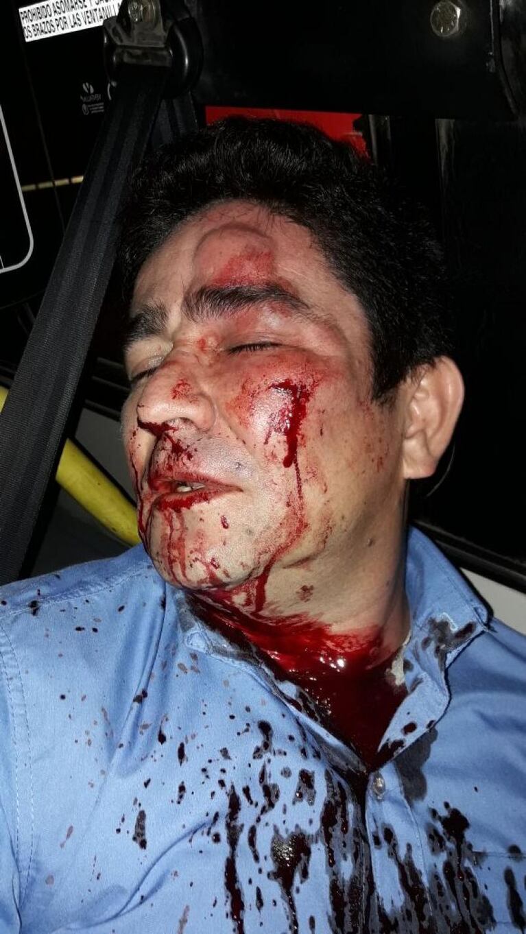 Un chofer de Ersa fue brutalmente atacado por unos ladrones en barrio Parque República
