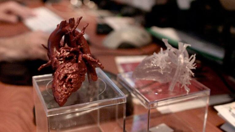 Un corazón impreso en 3D le cambió la vida a una nena