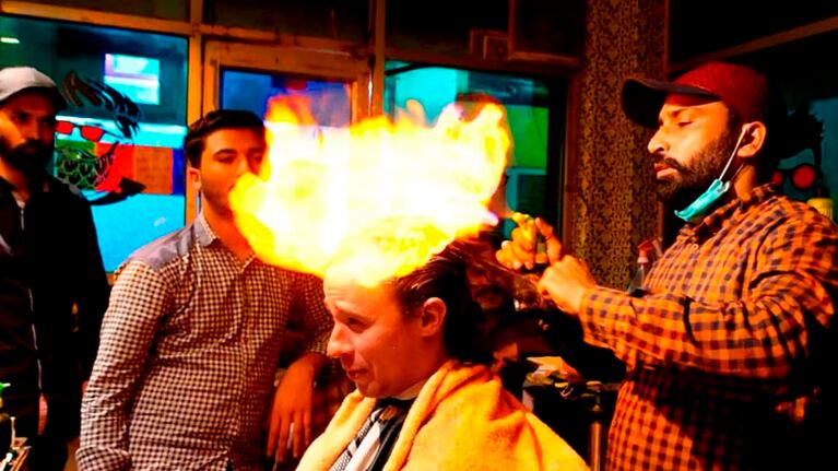 Un corte de pelo con fuego terminó muy mal. Foto ilustrativa.