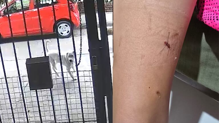 Un dogo atacó a una nena en Carlos Paz.