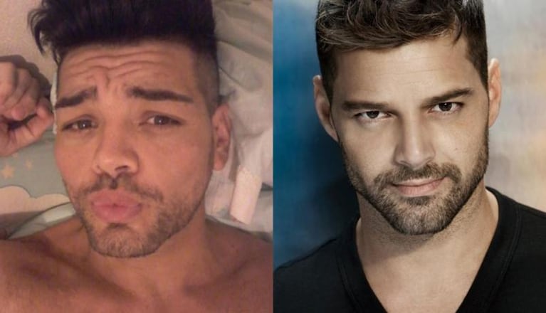  Un ex Cuestión de Peso se hizo 28 cirugías estéticas para parecerse a Ricky Martin