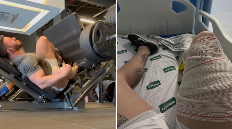 Un fisicoculturista intentó levantar 400 kilos en la prensa y sufrió una terrible lesión: el video