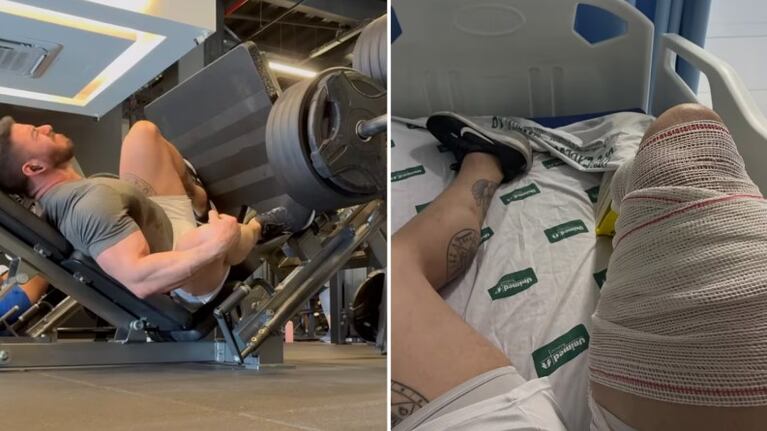 Un fisicoculturista intentó levantar 400 kilos en la prensa y sufrió una terrible lesión: el video
