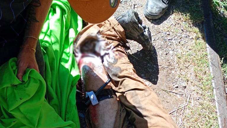 Un hombre fue arrollado por el tren en barrio José Ignacio Díaz.