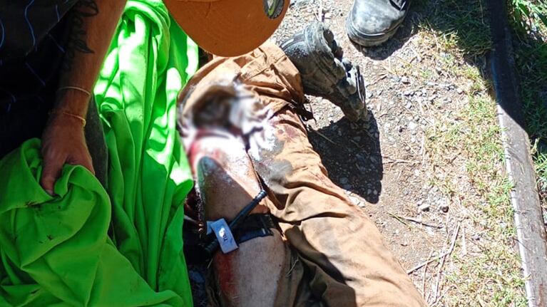 Un hombre fue arrollado por el tren en barrio José Ignacio Díaz tercera sección.