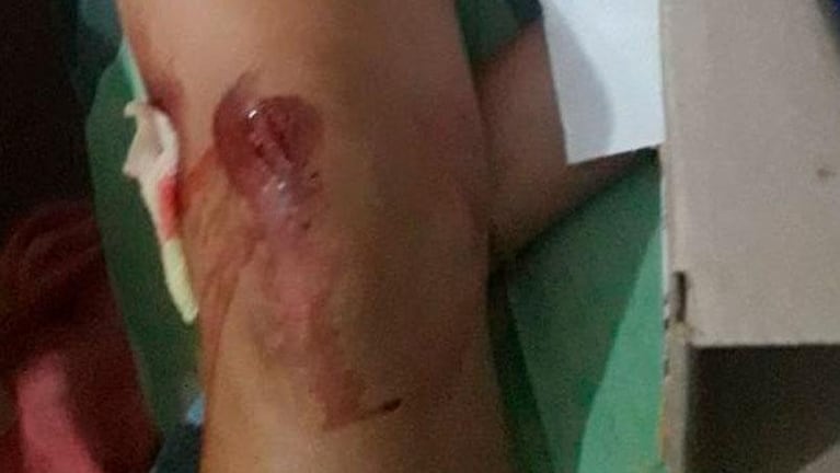 Un hombre ofreció llevarla, la menor aceptó y la atacó: ella se tiró del auto en marcha