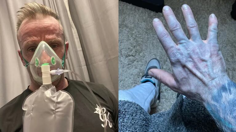 Un hombre se despertó con la piel de color azul y pensó lo peor