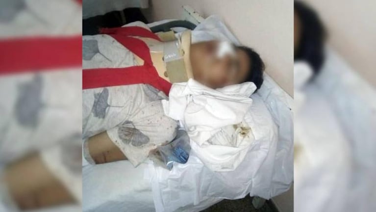 Un joven terminó inconsciente tras una pelea callejera en Oliva