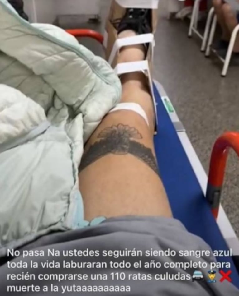 Un ladrón de 15 años provocó un accidente escapando de la Policía: su tremendo posteo desde el hospital