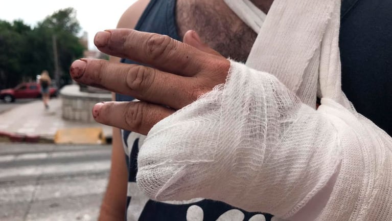 Un menor de edad armado le amputó el dedo meñique de un balazo. / Foto: Andy Ferreyra El Doce