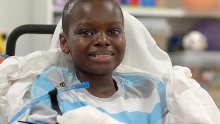 Un niño de 10 años sufrió cuatro amputaciones por una extraña enfermedad relacionada al Covid-19