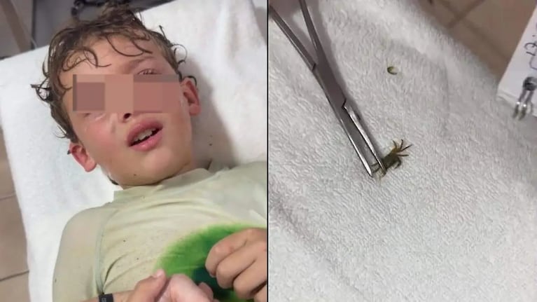 Un niño filmó el momento en que le sacaban del oído un cangrejo.