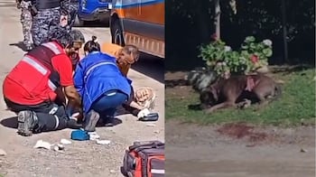 Un nuevo ataque de un perro pitbull, esta vez en Villa Allende.