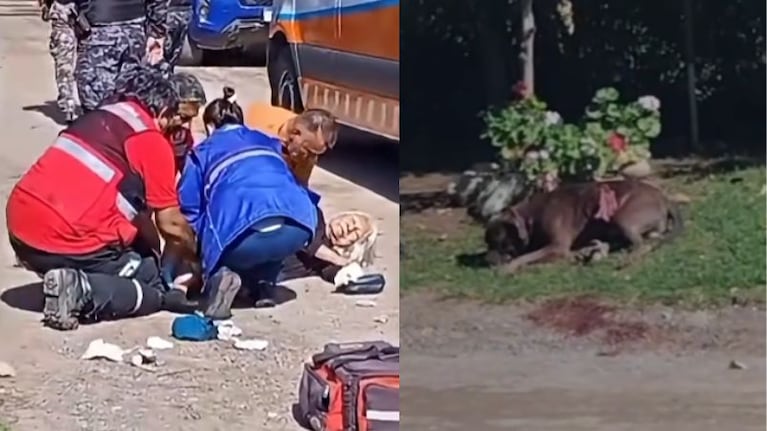Un nuevo ataque de un perro pitbull, esta vez en Villa Allende.