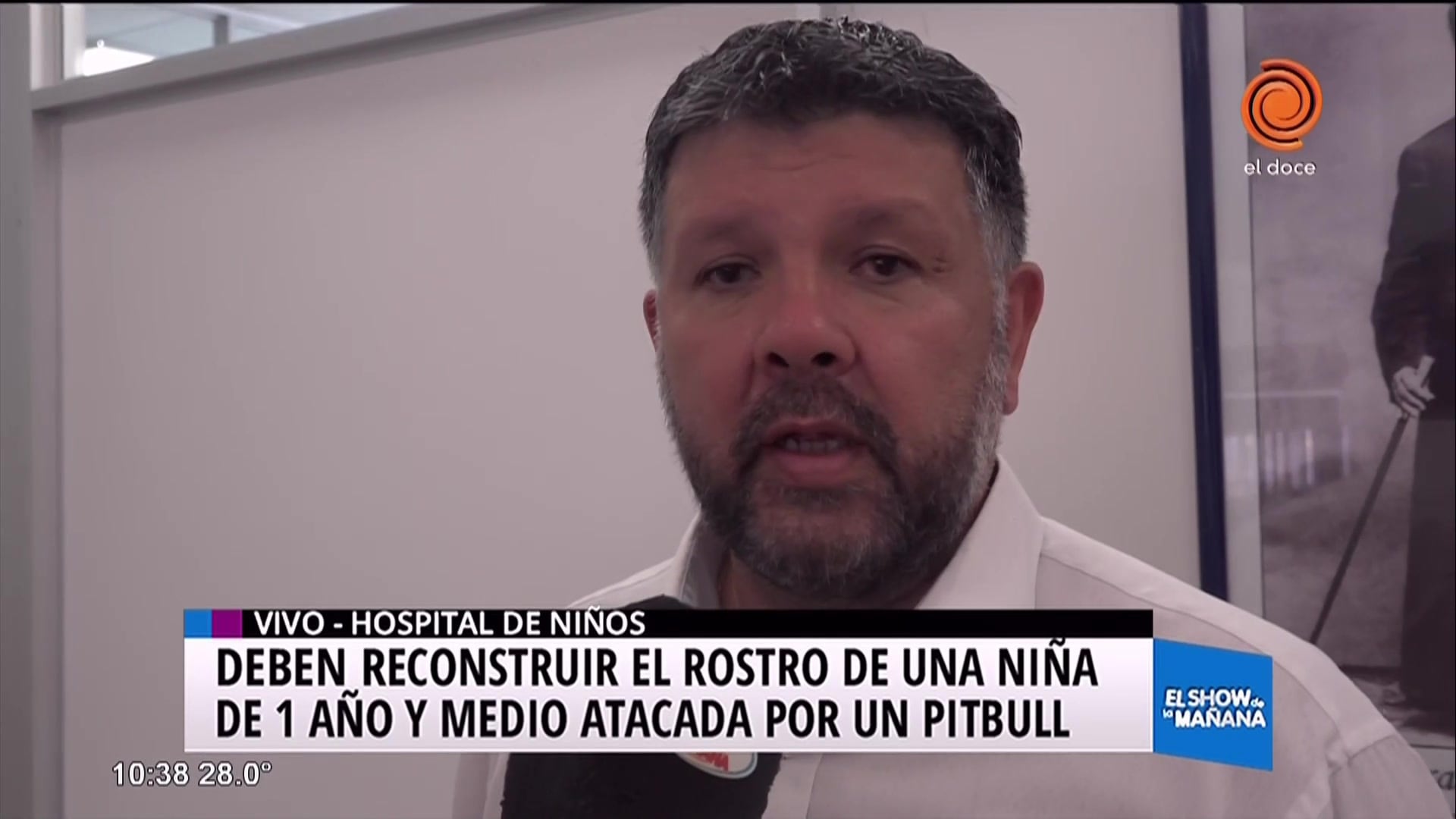 Un perro destrozó la cara de una nena