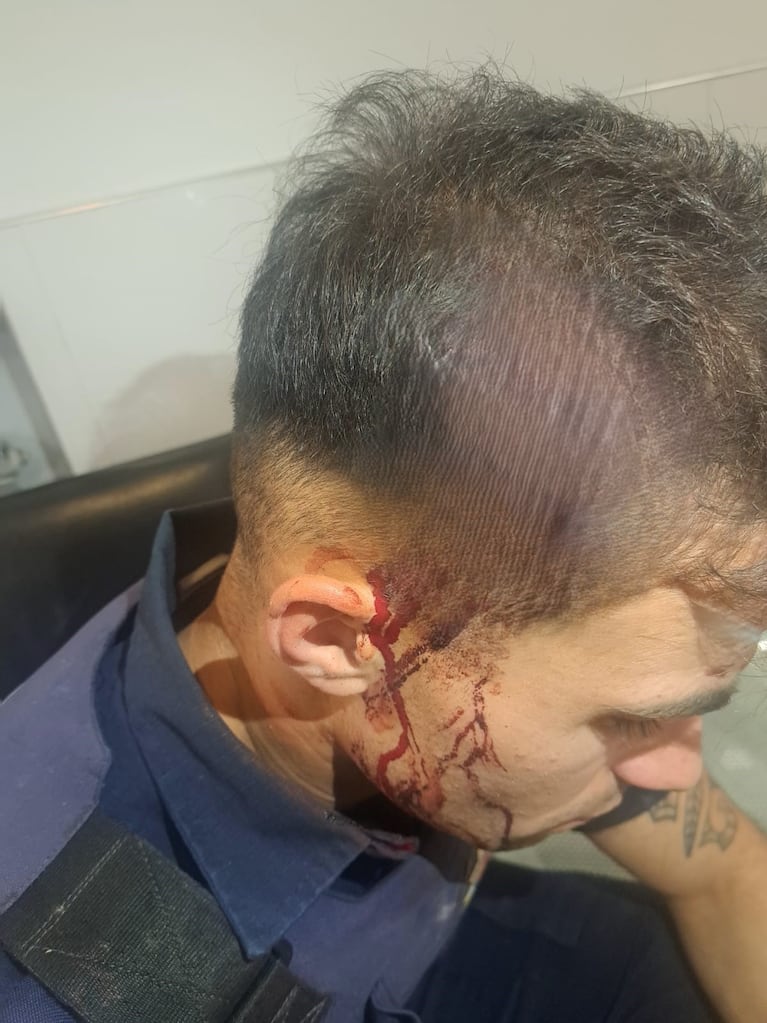 Un policía resultó con un corte en la cabeza.