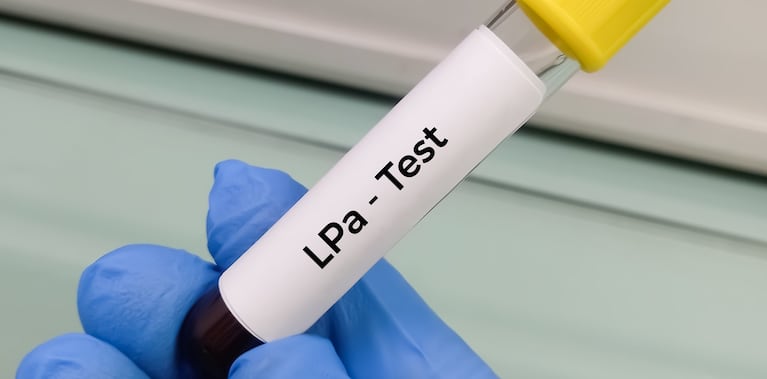 Un tercio de los argentinos tiene Lp(a) alto: qué es, por qué preocupa y cuáles son los riesgos