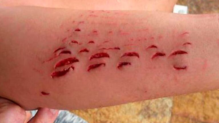 Un tiburón sedoso mordió a una turista en las costas de las Islas Canarias. 