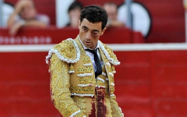 Un torero perdió la visión de su ojo izquierdo tras recibir una cornada