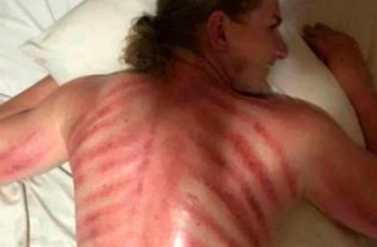 Un turista aceptó un masaje especial y se llevó la peor sorpresa