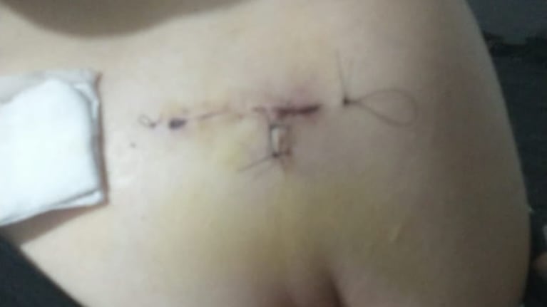 Una adolescente fue apuñalada en una terrible pelea filmada en Córdoba: el dramático relato