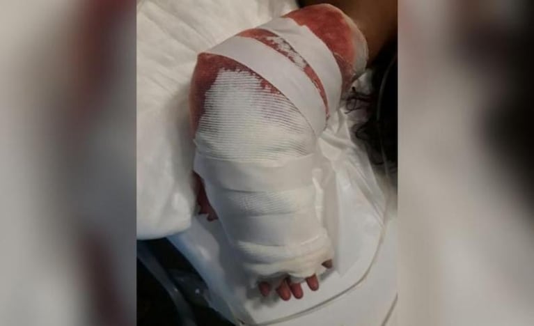 Una bebé metió el brazo en un secarropas y se lo arrancó