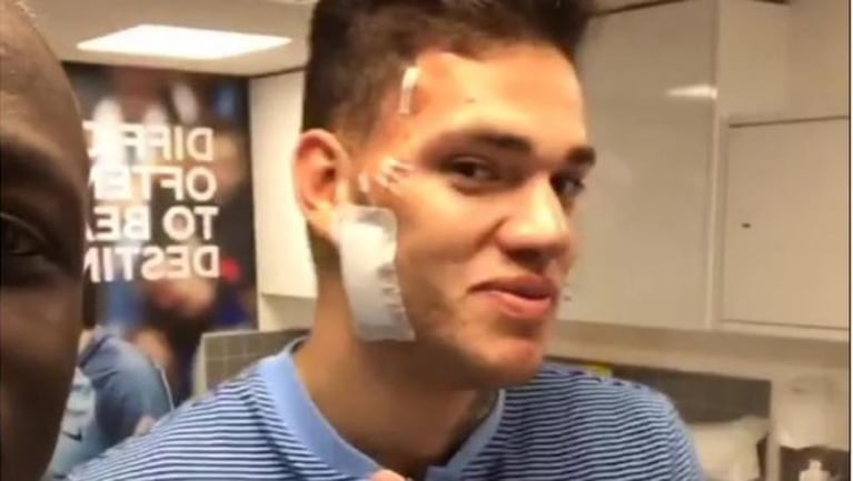 Una brutal patada desfiguró el rostro del arquero Ederson