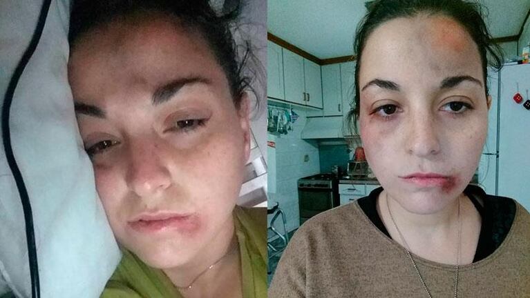 Una cordobesa se animó a mostrar el horror que vivió y las golpizas que le dio su pareja