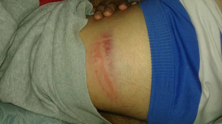 Una de las heridas que la Policía de Catamarca provocó en fanáticos de la Mona.