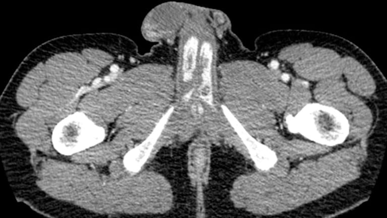 Una de las imágenes médicas del caso que fue estudiado por especialistas. / Foto: Case Reports in Urology