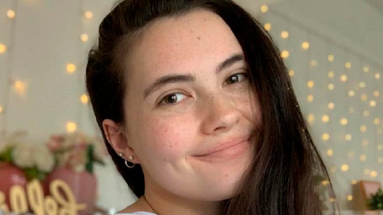 Una joven alérgica al agua no puede tomar ni un sorbo porque le corta la lengua