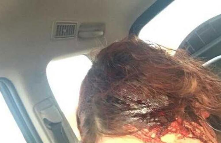 Una joven fue atacada a hachazos: el agresor le dijo "me tiene harto el 8M"