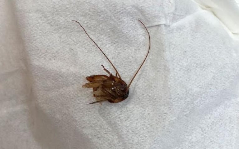 Una joven tuvo una cucaracha en su oído durante nueve días