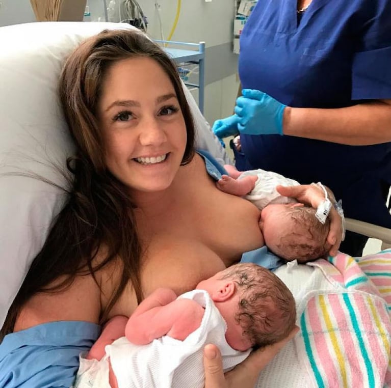 Una mamá mostró las cicatrices de su panza tras dar a luz