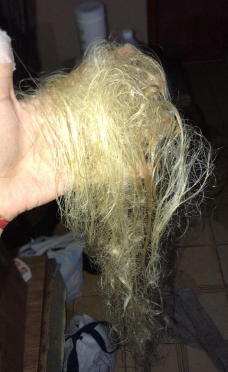 Una peluquera la dejó pelada antes de sus 15 y ahora volvió a sonreír con sus extensiones 