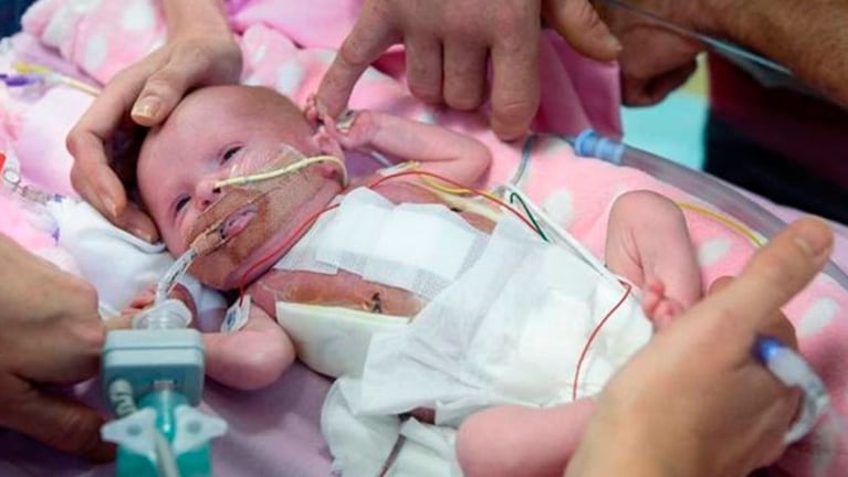 Vanellope Hope Wilkins sobrevivió a tres cirugías tras nacer.