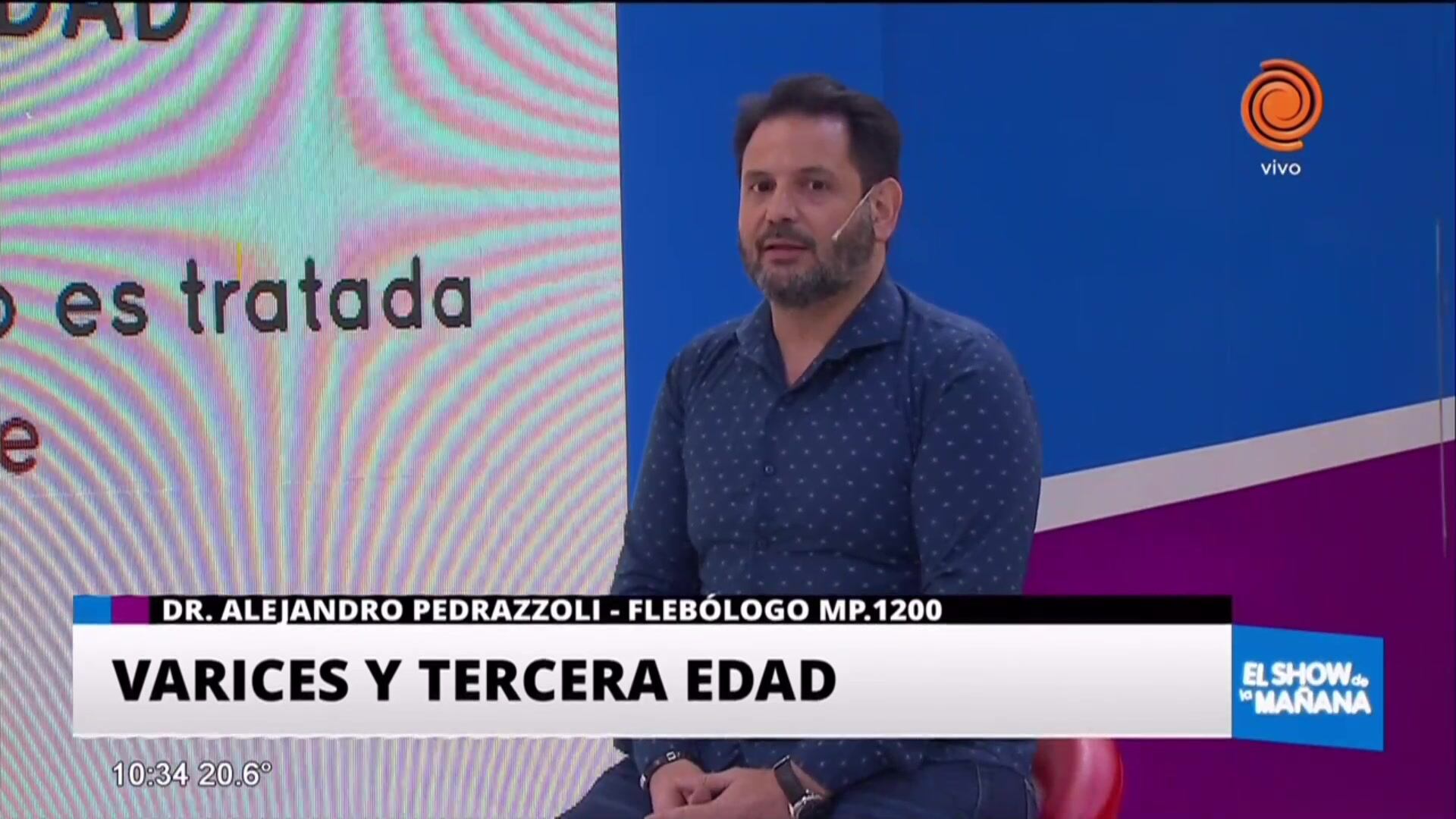 Várices en la tercera edad