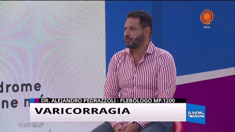 Varicorragia: Causas y tratamiento