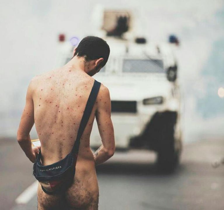 Venezuela: un soldado le disparó a una mujer que lo filmaba