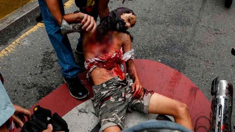 Venezuela: una bomba lacrimógena mató a un joven