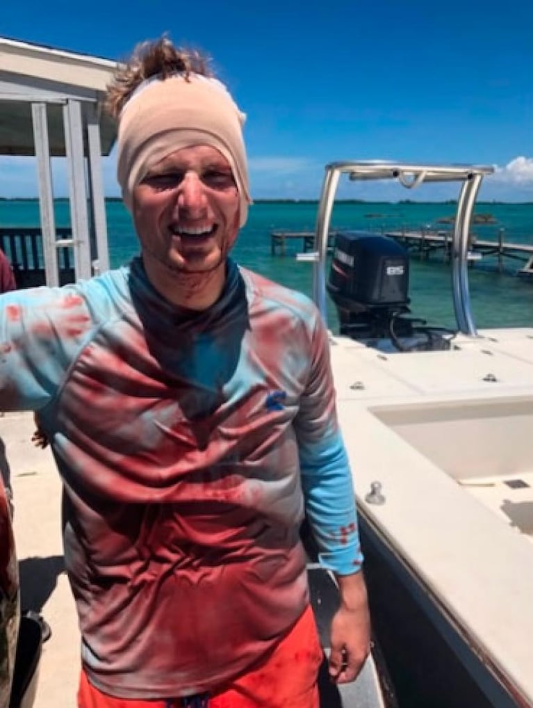 Video: un tiburón le mordió la cabeza a un pescador en las Bahamas