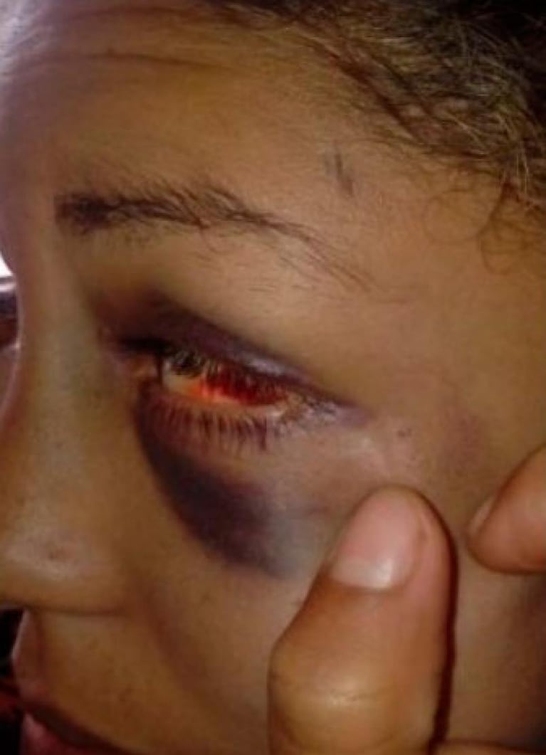 Villa María: una joven fue brutalmente golpeada por su expareja